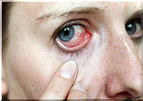 Pain in the eye cancer