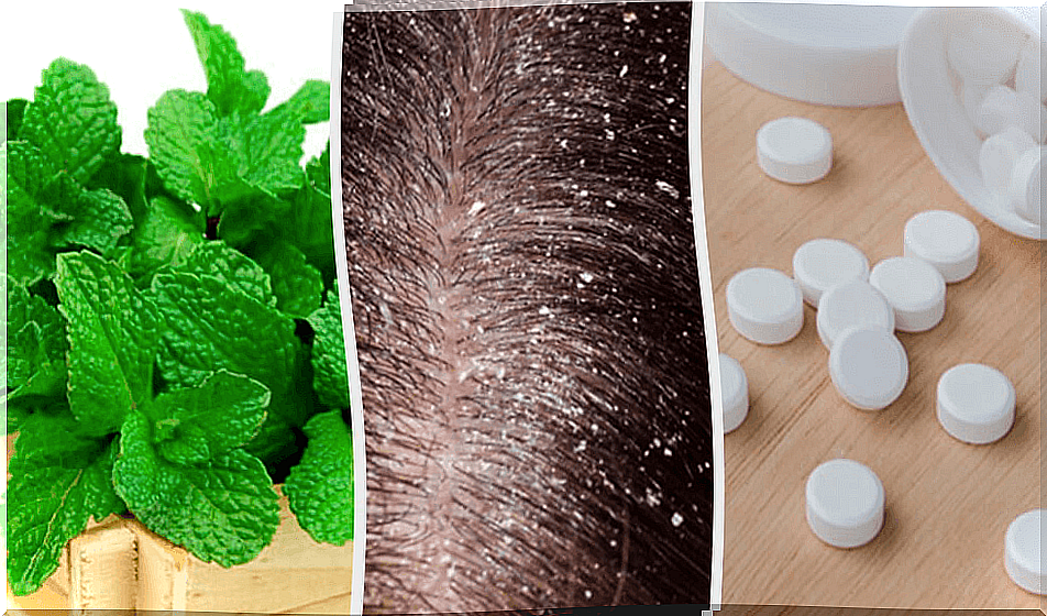 7 home remedies for dandruff