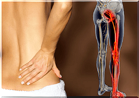 8 natural remedies to treat sciatica