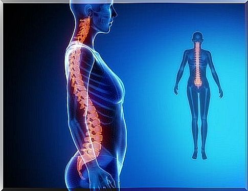 Arthrosis of the spine: diagnosis and treatment