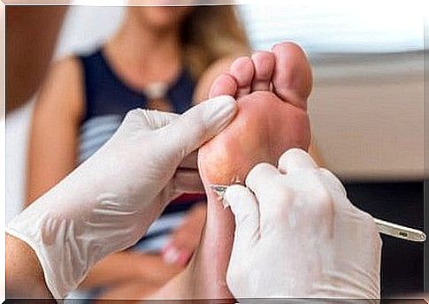 Calluses on the feet: the best alternatives to remove them