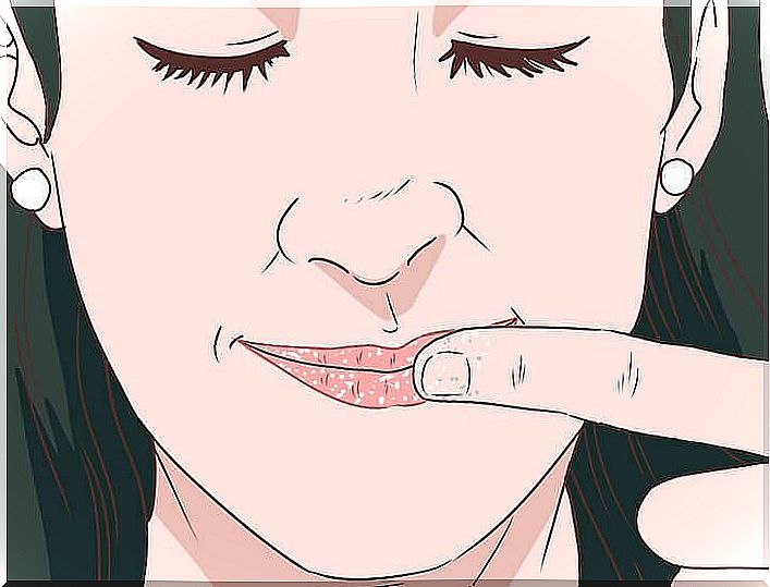 Chapped lips: 6 tips to treat them