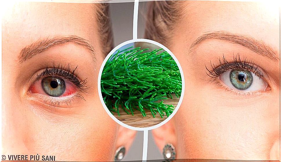 Conjunctivitis: 7 tips to eliminate it naturally