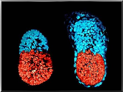 The fetus in fetu occurs before the embryo is formed.