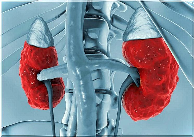 Kidneys with hyperchloremic renal acidosis