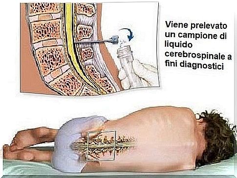 Lumbar puncture description