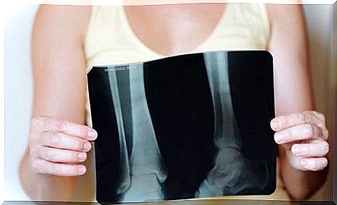 Maintain bone density after menopause