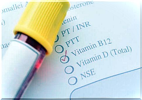 Methylmalonic acidemia: diagnosis and treatment