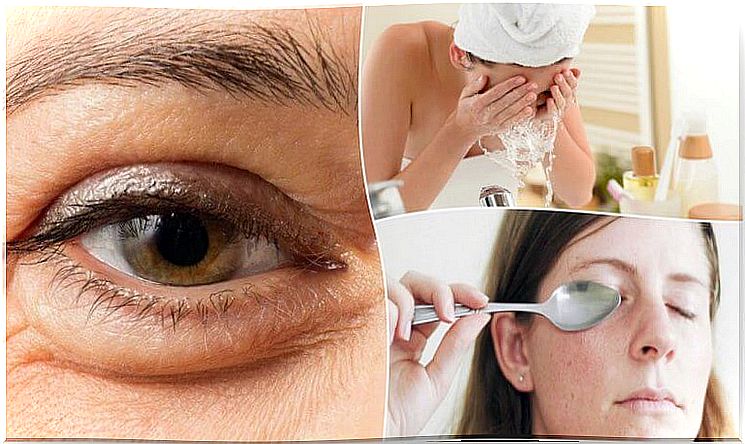 Reduce bags under the eyes: 6 natural methods