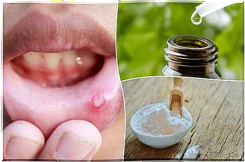 Relieve mouth ulcers with 6 natural remedies