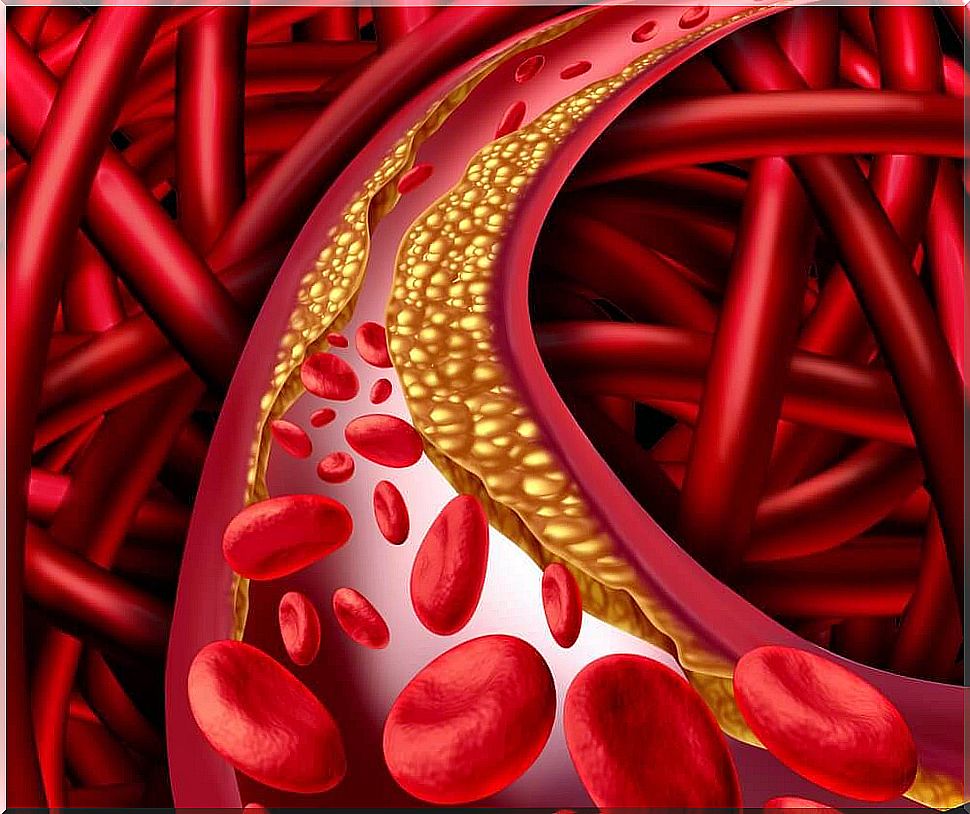 Cholesterol in the blood