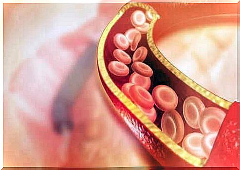 Thrombophlebitis is an inflammatory process of the blood.