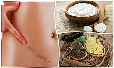 The 7 best natural remedies to reduce scars